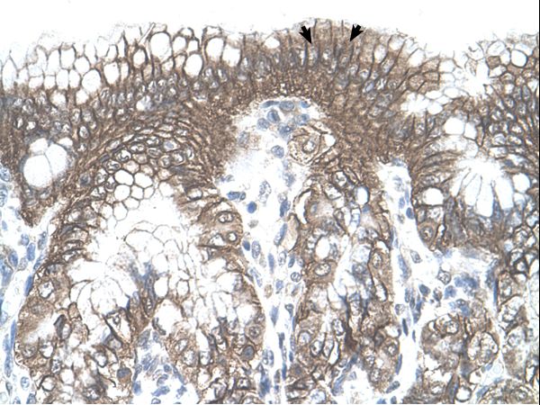TARS antibody LS-C82495 was used in IHC to stain formalin-fixed, paraffin-embedded human stomach.