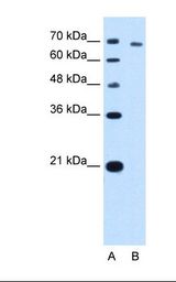 Lane A: Marker. Lane B: HepG2 cell lysate. Antibody concentration: 5.0 ug/ml. Gel concentration: 12%.