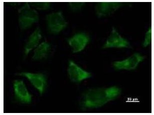 Immunofluorescent staining using TARS antibody. Immunostaining analysis in HeLa cells. HeLa cells were fixed with 4% paraformaldehyde and permeabilized with 0.01% Triton-X100 in PBS. The cells were immunostained with anti-TARS antibody.