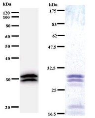 Western blot of immunized recombinant protein using TARS antibody. Left: TARS staining. Right: Coomassie Blue staining of immunized recombinant protein.