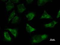 Immunostaining analysis in HeLa cells. HeLa cells were fixed with 4% paraformaldehyde and permeabilized with 0.1% Triton X-100 in PBS. The cells were immunostained with anti-TARS mAb.