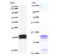 Left : Western blot analysis of immunized recombinant protein, using anti-TARS monoclonal antibody. Right : CBB staining of immunized recombinant protein.