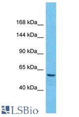 TARSH / ABI3BP antibody Western Blot of Thymus Tumor. Antibody dilution: 1 ug/ml.