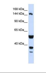 Hela cell lysate. Antibody concentration: 1.0 ug/ml. Gel concentration: 6-18%.