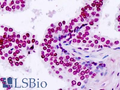 Human, Prostate: Formalin-Fixed Paraffin-Embedded (FFPE)
