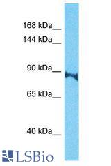 TARSL2 antibody Western Blot of HepG2. Antibody dilution: 1 ug/ml.