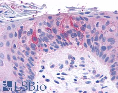 Anti-TAS1R2 antibody LS-A2007 IHC of human taste receptor cells. Immunohistochemistry of formalin-fixed, paraffin-embedded tissue after heat-induced antigen retrieval.