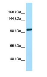 TAS1R2 / T1R2 antibody Western Blot of Fetal Brain.