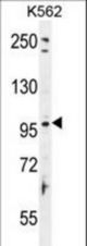 TAS1R2 Antibody western blot of K562 cell line lysates (35 ug/lane). The TAS1R2 antibody detected the TAS1R2 protein (arrow).