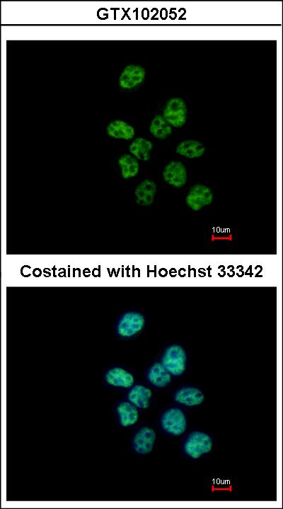 Immunofluorescence of paraformaldehyde-fixed A431 using PUF60 antibody at 1:500 dilution.