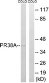 Western blot of extracts from COLO cells, using PRPF38A Antibody. The lane on the right is treated with the synthesized peptide.