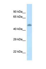 TAT / Tyrosine Aminotransferase antibody LS-C145603 Western blot of Rat Brain lysate. Antibody concentration 1 ug/ml.