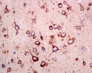 IHC of paraffin-embedded human brain tissue using anti-Tyrosine Aminotransferase antibody.
