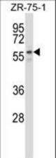 PUF60 Antibody western blot of ZR-75-1 cell line lysates (35 ug/lane). The PUF60 antibody detected the PUF60 protein (arrow).