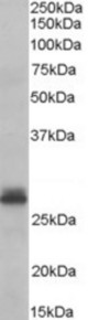 Antibody (0.3 ug/ml) staining of Human Heart lysate (35 ug protein in RIPA buffer). Primary incubation was 1 hour. Detected by chemiluminescence.