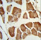 Formalin-fixed and paraffin-embedded human skeletal muscle reacted with TAZ Antibody , which was peroxidase-conjugated to the secondary antibody, followed by DAB staining. This data demonstrates the use of this antibody for immunohistochemistry; clinical relevance has not been evaluated.