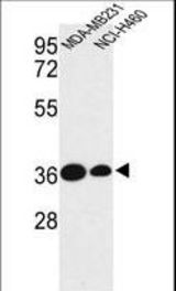 Western blot of TAZ Antibody in MDA-MB231, NCI-H460 cell line lysates (35 ug/lane). TAZ (arrow) was detected using the purified antibody.