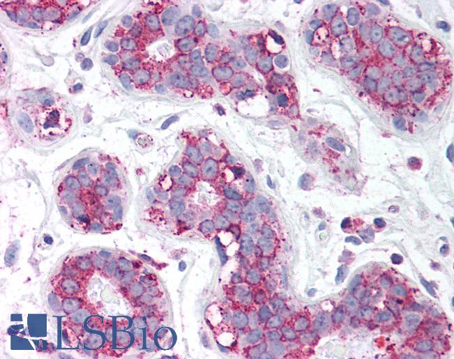Anti-TBC1D1 antibody IHC of human breast. Immunohistochemistry of formalin-fixed, paraffin-embedded tissue after heat-induced antigen retrieval. Antibody LS-B1410 concentration 5 ug/ml.