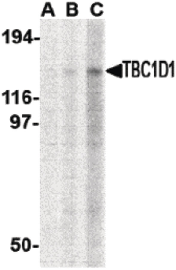 Western blot of TBC1D1 in Daudi cell lysate with TBC1D1 antibody at (A) 1, (B) 2 and (C) 4 ug/ml.