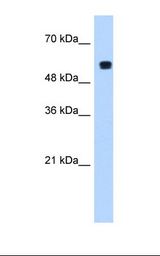 Transfected 293T cell lysate. Antibody concentration: 1.25 ug/ml. Gel concentration: 12%.