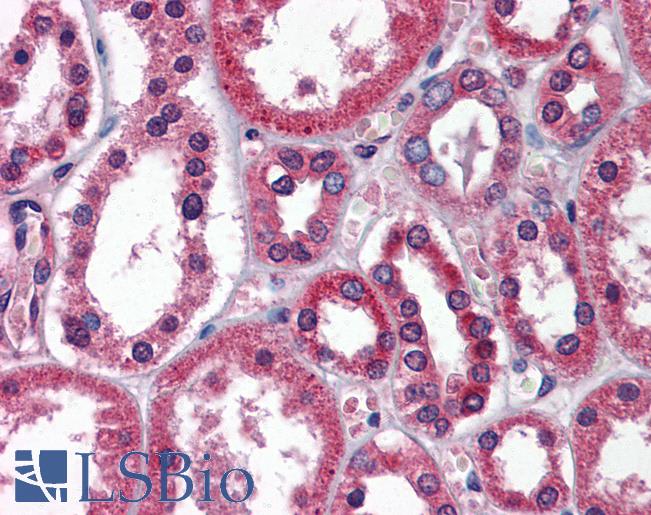 Anti-TBC1D1 antibody IHC of human kidney. Immunohistochemistry of formalin-fixed, paraffin-embedded tissue after heat-induced antigen retrieval. Antibody LS-B5862 concentration 5 ug/ml.