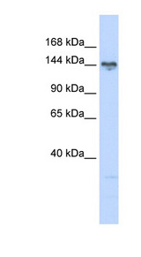 TBC1D1 antibody LS-B5862 Western blot of 721_B cell lysate.