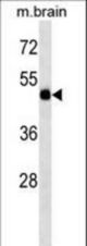 TBC1D10A Antibody western blot of mouse brain tissue lysates (35 ug/lane). The TBC1D10A antibody detected the TBC1D10A protein (arrow).