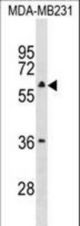 TBC1D10A Antibody western blot of MDA-MB231 cell line lysates (35 ug/lane). The TBC1D10A antibody detected the TBC1D10A protein (arrow).