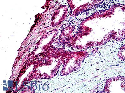 Anti-TBC1D10A antibody IHC of human prostate. Immunohistochemistry of formalin-fixed, paraffin-embedded tissue after heat-induced antigen retrieval. Antibody LS-B5101 concentration 4.75 ug/ml.