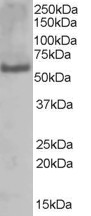 Antibody (1 ug/ml) staining of A431 lysate (35 ug protein in RIPA buffer). Primary incubation was 1 hour. Detected by chemiluminescence.