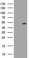 HEK293T cells were transfected with the pCMV6-ENTRY control (Left lane) or pCMV6-ENTRY TBC1D13 (Right lane) cDNA for 48 hrs and lysed. Equivalent amounts of cell lysates (5 ug per lane) were separated by SDS-PAGE and immunoblotted with anti-TBC1D13.