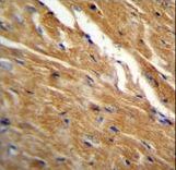 TBC1D13 Antibody immunohistochemistry of formalin-fixed and paraffin-embedded mouse heart tissue followed by peroxidase-conjugated secondary antibody and DAB staining.