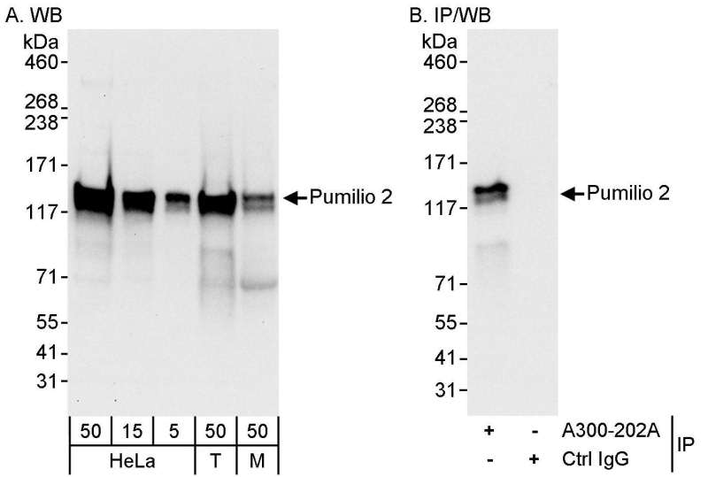 Detection of Human and Mouse Pumilio 2 by Western Blot (h&m) and Immunoprecipitation (h). Samples: Whole cell lysate from HeLa (5, 15 and 50 ug for WB; 1 mg for IP, 20% of IP loaded), 293T (T; 50 ug), and mouse NIH3T3 (M; 50 ug) cells. Antibodies: Affinity purified rabbit anti-Pumilio 2 antibody used for WB at 0.2 ug/ml (A) and 1 ug/ml (B) and used for IP at 3 ug/mg lysate. Detection: Chemiluminescence with exposure times of 10 seconds (A) and 3 seconds (B).