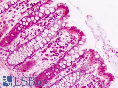 Human Colon: Formalin-Fixed, Paraffin-Embedded (FFPE)