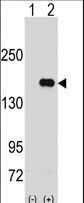 Western blot of PUM2 (arrow) using rabbit polyclonal PUM2 Antibody. 293 cell lysates (2 ug/lane) either nontransfected (Lane 1) or transiently transfected with the PUM2 gene (Lane 2) (Origene Technologies).