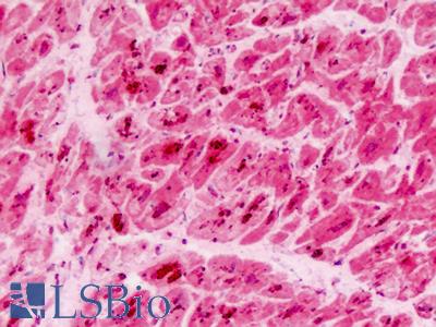 Human Heart: Formalin-Fixed, Paraffin-Embedded (FFPE)