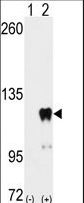 Western blot of PUM2 (arrow) using PUM2 Antibody (S182). 293 cell lysates (2 ug/lane) either nontransfected (Lane 1) or transiently transfected with the PUM2 gene (Lane 2) (Origene Technologies).