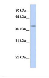 Fetal brain lysate. Antibody concentration: 1.0 ug/ml. Gel concentration: 12%.