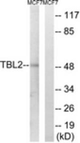 Western blot of extracts from MCF-7 cells, using TBL2 Antibody. The lane on the right was incubated with synthetic peptide.