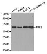 Western blot analysis of extracts of various cell lines, using TBL2 antibody.