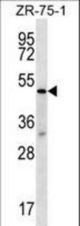 TBL2 Antibody western blot of ZR-75-1 cell line lysates (35 ug/lane). The TBL2 antibody detected the TBL2 protein (arrow).