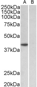 TBP antibody (1 ug/ml) staining of HeLa nuclear (A) and cytosolic (B) lysates (35 ug protein in RIPA buffer). Primary incubation was 1 hour. Detected by chemiluminescence.