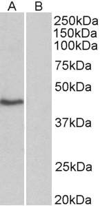 TBP antibody (0.3 ug/ml) staining of HeLa nuclear (A) and cytosolic (B) lysates (35 ug protein in commercial extraction buffer). Primary incubation was 1 hour. Detected by chemiluminescence.