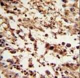Formalin-fixed and paraffin-embedded human testis tissue reacted with TBP Antibody , which was peroxidase-conjugated to the secondary antibody, followed by DAB staining. This data demonstrates the use of this antibody for immunohistochemistry; clinical relevance has not been evaluated.