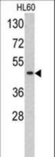 Western blot of TBP antibody in HL60 cell line lysates (35 ug/lane). TBP (arrow) was detected using the purified antibody.