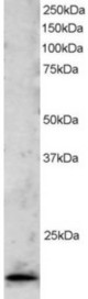 Antibody staining (2 ug/ml) of Jurkat lysate (RIPA buffer, 30 ug total protein per lane). Primary incubated for 1 hour. Detected by Western blot of chemiluminescence.