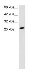 HepG2 Cell Lysate