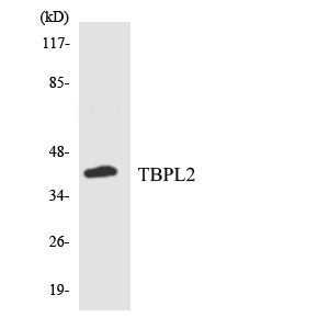 Western blot of the lysates from COLO205 cells using TBPL2 antibody.