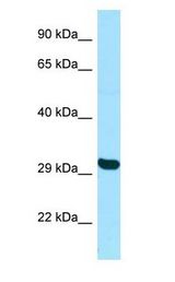 TBPL2 / TRF3 antibody Western Blot of HepG2.