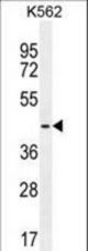 TBPL2 Antibody western blot of K562 cell line lysates (35 ug/lane). The TBPL2 antibody detected the TBPL2 protein (arrow).